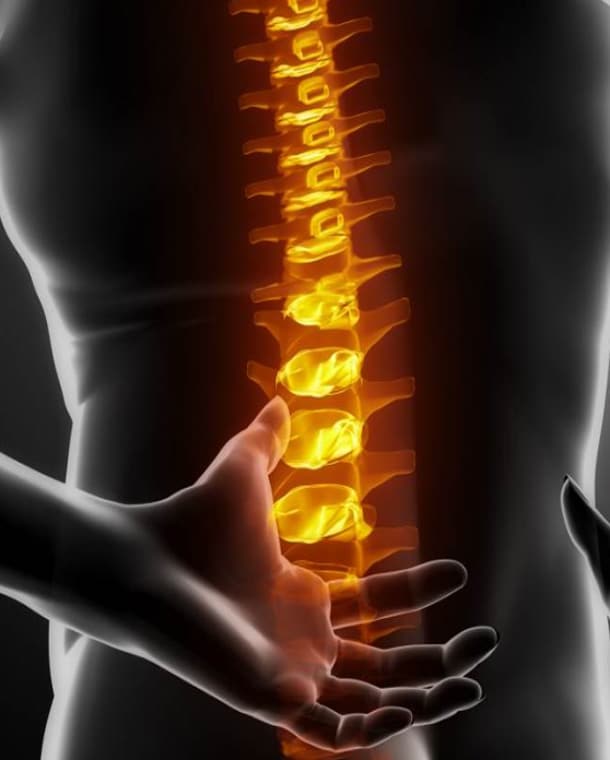 Spinal Decompression